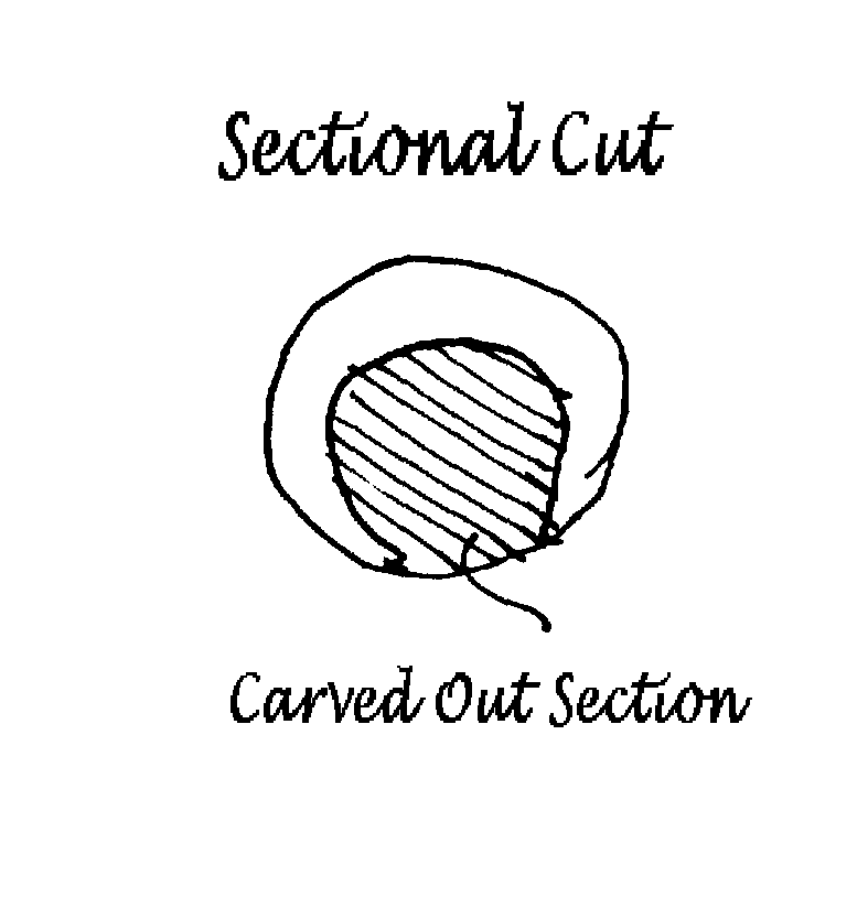 Sketch 14 from the yew case study